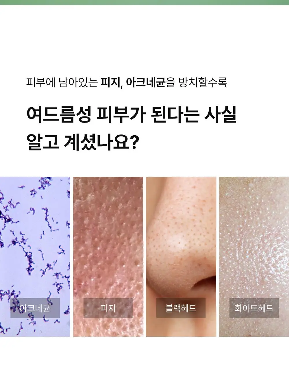 [단독기획] 동아제약 아크네 프로 겔제 30ml 기획(+3ml+크림제3ml) 상세페이지 6